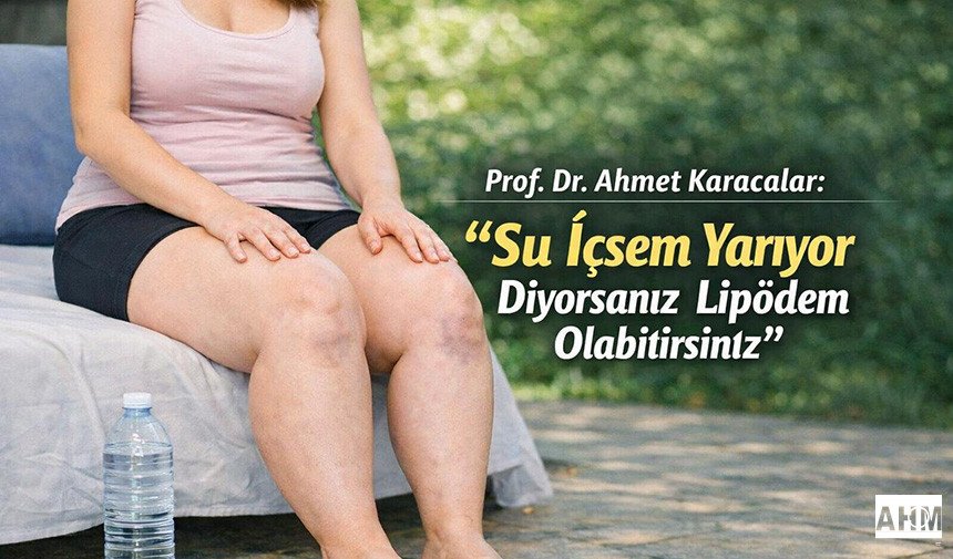 Prof. Dr. Ahmet Karacalar "Su İçsem Yarıyor Diyorsanız Lipödem Olabilirsiniz"